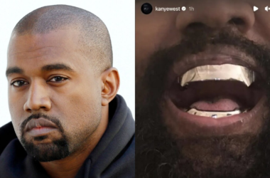 Kanye West reportedly replaced his teeth with $850k James Bond-inspired Titanium dentures 12 www.talentsofworld.com | Talentsofworld Articles