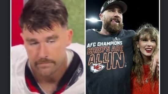 Travis Kelce and Taylor Swift's fans expressed worries after “Catching Kelce” appeared downcast in viral video during the Kansas City Chiefs game against the Atlanta Falcons Sunday night.(X/AP)