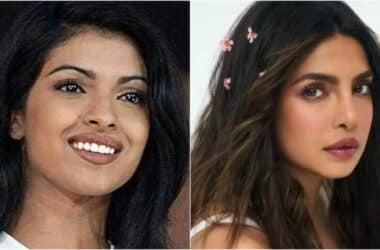 Surgery gone wrong: When Priyanka Chopra’s honest confession on her botched nose surgery reminded of its consequences | Hindi Movie News - Times of India 13 Surgery gone wrong: When Priyanka Chopra’s honest confession on her botched nose surgery reminded of its consequences | Hindi Movie News - Times of India