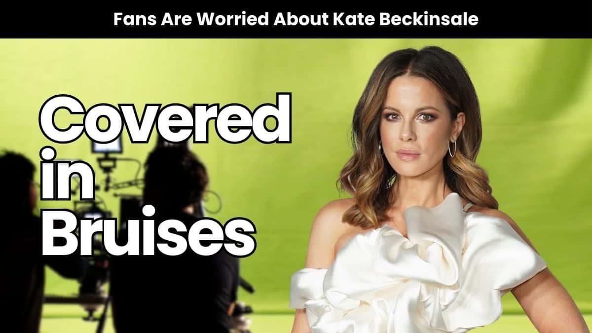 Fans Worried About Kate Beckinsale After Seeing Concerning Photos 8 Fans Worried About Kate Beckinsale After Seeing Concerning Photos