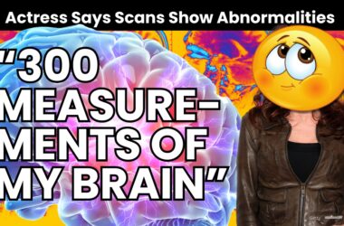 Hallmark Star Reveals She Undergoes Tests 'All the Time' for Rare Condition 13 Hallmark Star Reveals She Undergoes Tests 'All the Time' for Rare Condition