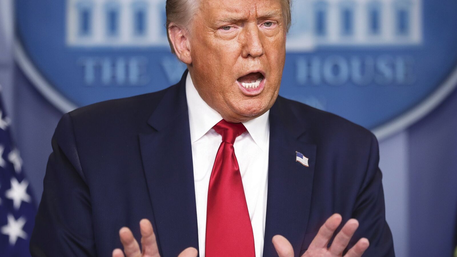 Reciprocal tariff impact: Trump says, ‘like when patients get operated’ as US markets suffer worst day since Covid crash | Today News 7 menu