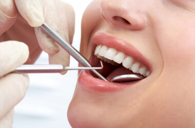 A Simple Guide to Straightening Your Teeth the Right Way 15 A Simple Guide to Straightening Your Teeth the Right Way