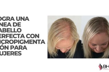 Logra una Línea de Cabello Perfecta con Micropigmentación para Mujeres 14 micropigmentacion para mujeres