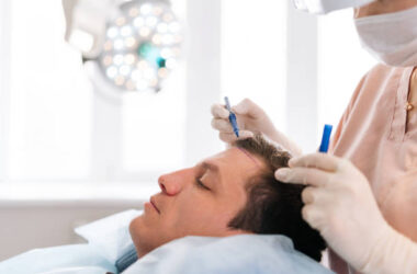 NeoGraft, ARTAS, and Beyond: The Future of Robotic Hair Transplant in Riyadh 15 Hair Transplant in Riyadh